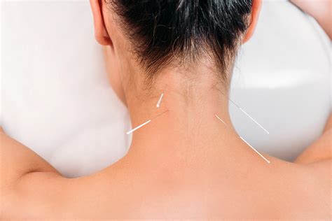 acupuncture mental health